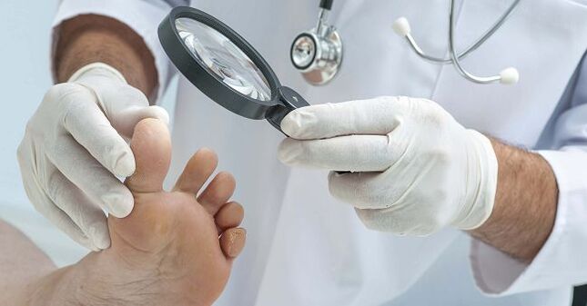 The doctor will prescribe a remedy for the toenail fungus after the diagnosis of the disease