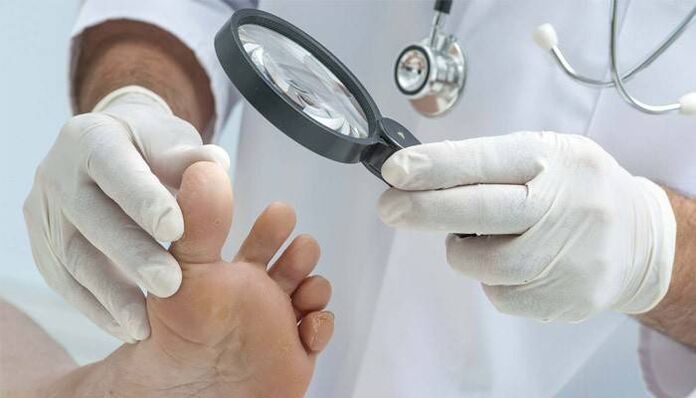 examining the feet for fungus between the toes